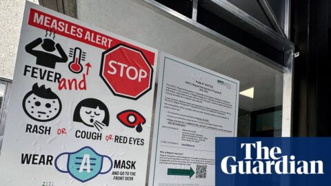 a measles alert sign